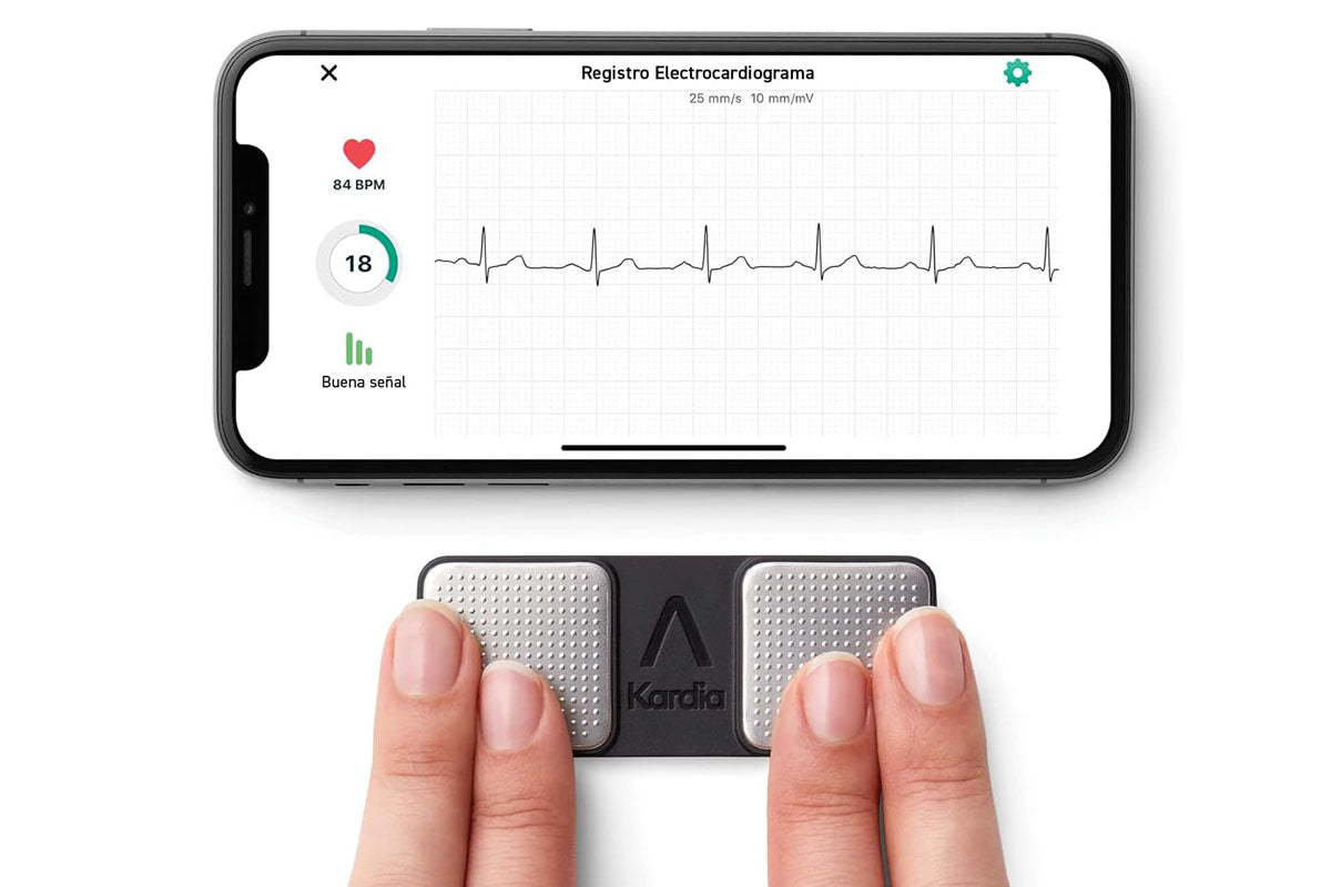 AliveCor KardiaMobile Single Lead Smart App ECG/EKG and Heart Monitor