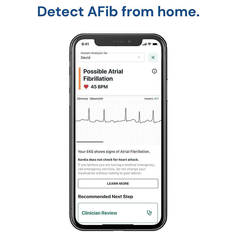 AliveCor KardiaMobile Single Lead Smart App ECG/EKG and Heart Monitor