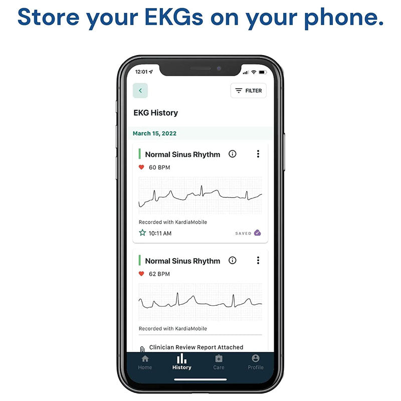 AliveCor KardiaMobile Single Lead Smart App ECG/EKG and Heart Monitor