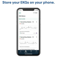 Thumbnail for AliveCor KardiaMobile Single Lead Smart App ECG/EKG and Heart Monitor