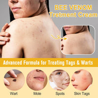 Thumbnail for Bee Venom Moles and Warts Removal Cream