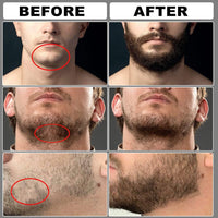 Thumbnail for Beard Grooming Kit