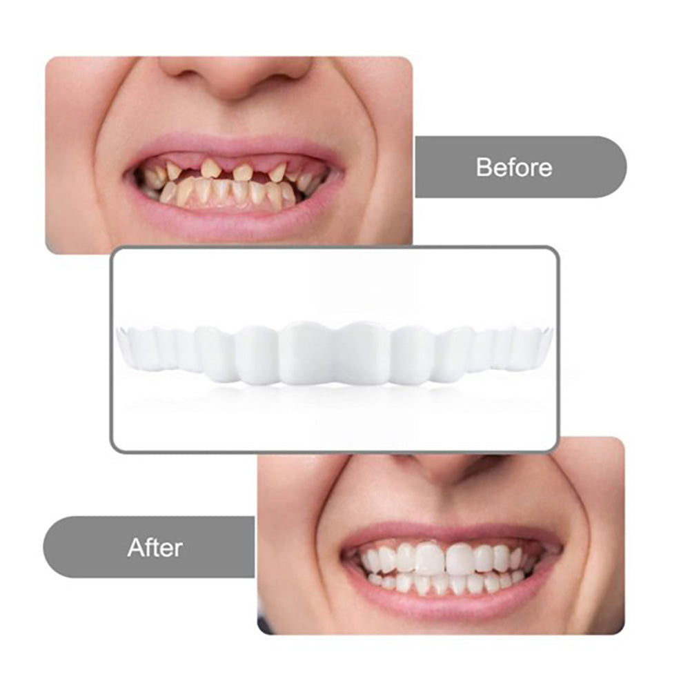 Perfect Smile Instant False Teeth Hot Whitening Snap Perfect Smile Teeth Fake Tooth Cover