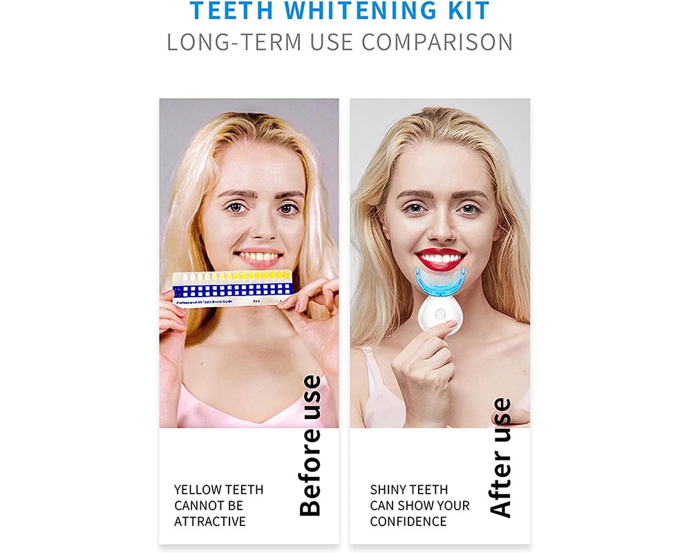 Teeth whitening kit Dental Whitener Kit