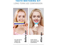 Thumbnail for Teeth whitening kit Dental Whitener Kit