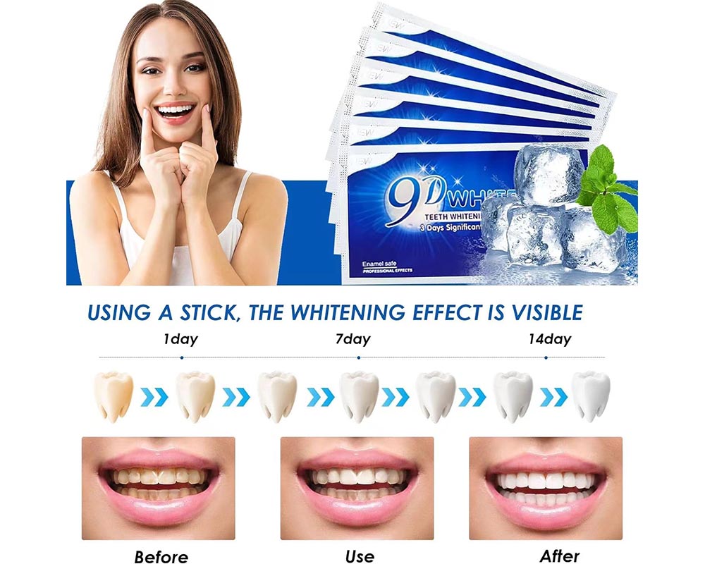 Teeth Whitening Strips kit