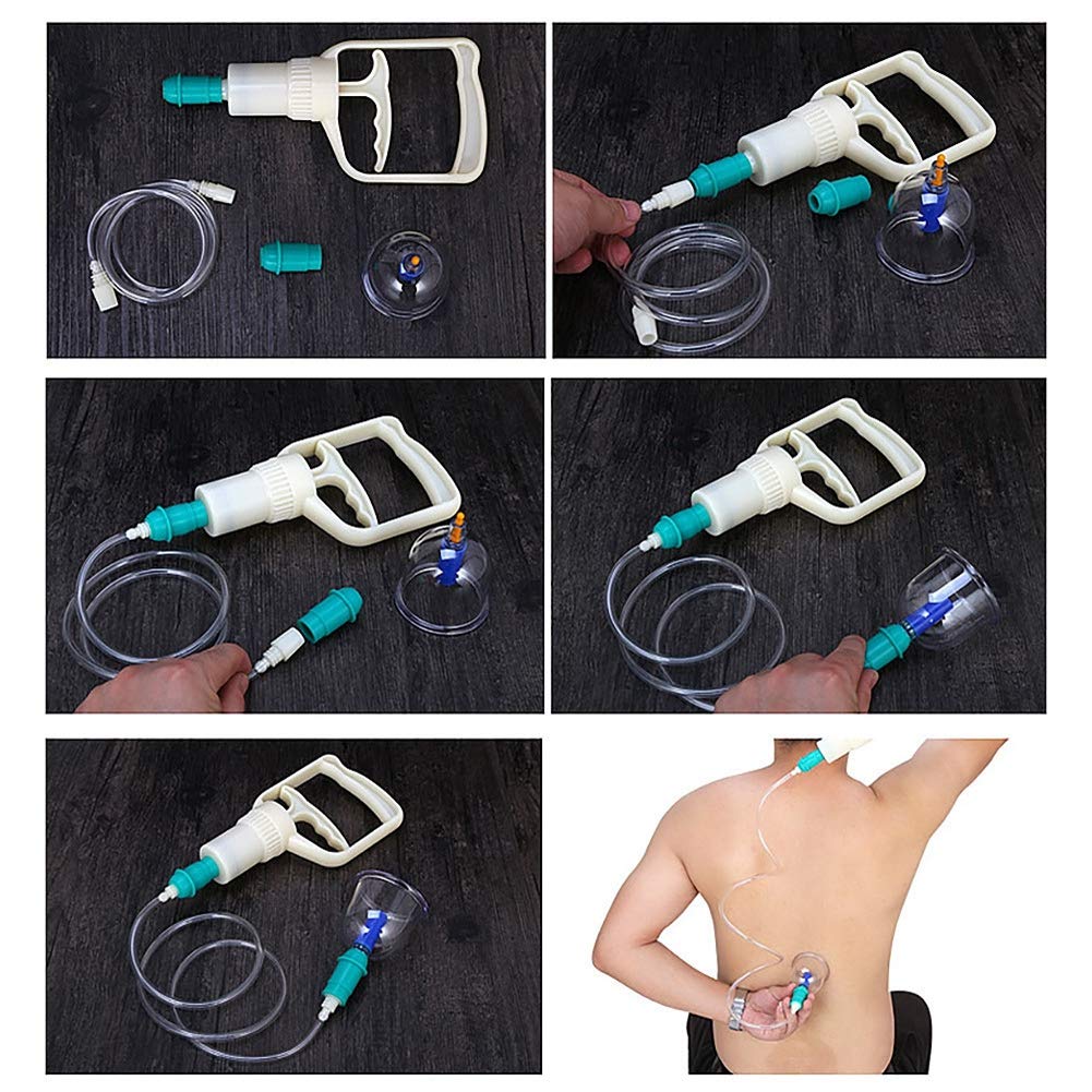 Massage Vacuum Cupping Set 24pcs