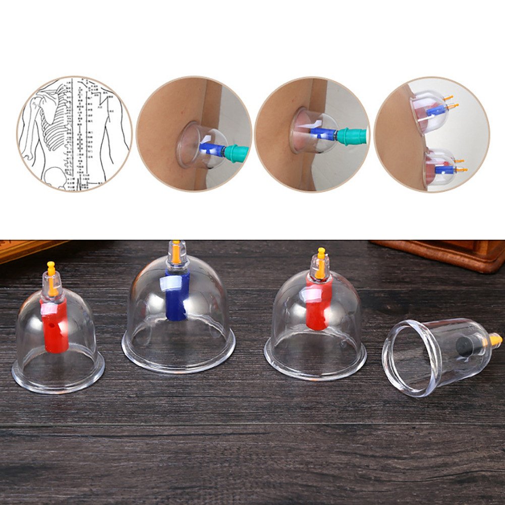 Massage Vacuum Cupping Set 24pcs