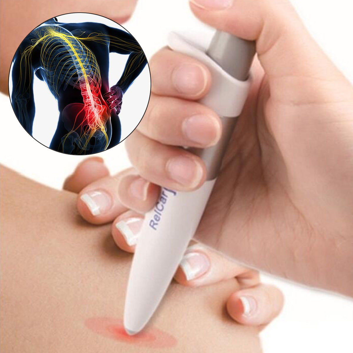 Acupuncture Pen Analgesia Pain Relief Pen